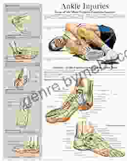 Ankle Injuries E Chart: Quick Reference Guide